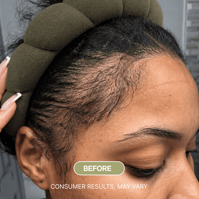Sulane™ Wonder Growth Oil Serum