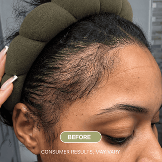 Sulane™ Wonder Growth Oil Serum