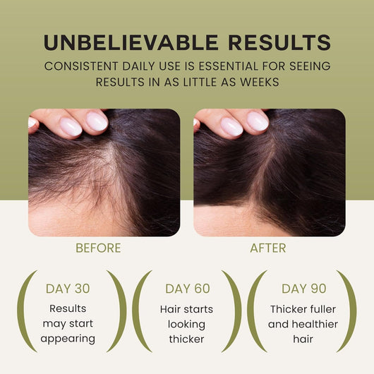 Sulane™ Wonder Growth Oil Serum