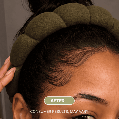 Sulane™ Wonder Growth Oil Serum