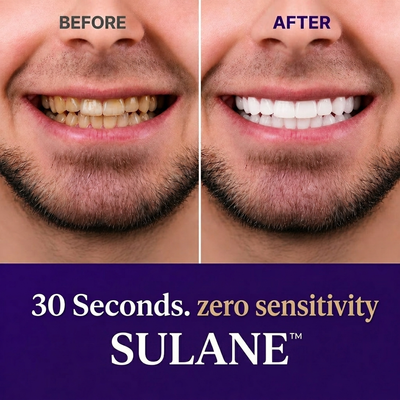 Sulane™ Purple Mouthwash